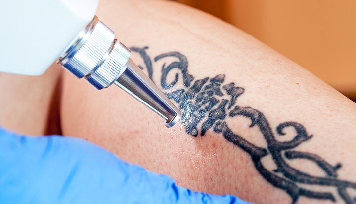 how to clean a bleeding tattoo